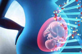 Fetal Dna Testi Nasıl Yapılır