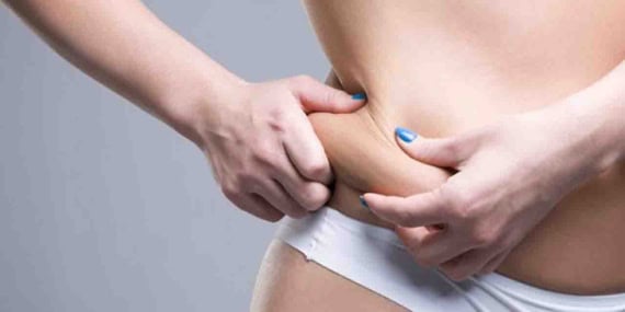 Liposuction mı, Karın Germe mi